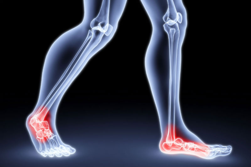 Common Ankle Problems in Kenosha, WI Treated by Podiatrists