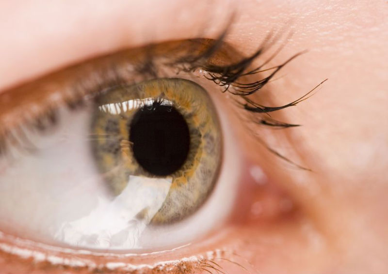 Do You Need LASIK Eye Surgery in Madison, AL?