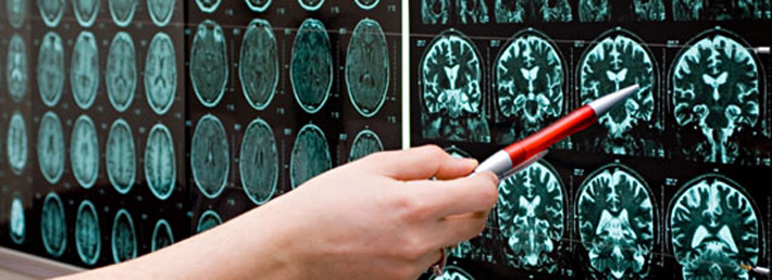 3 Reasons Why Your Doctor May Order Magnetic Resonance Imaging