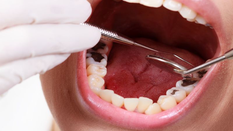 Smile Happy in Detroit, MI: Why Getting Your Teeth Whitened is a Good Idea