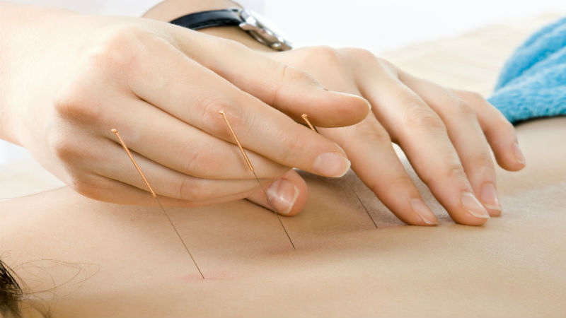 Your Guide to Finding Acupuncture in Asheville NC