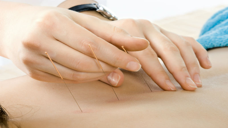 Unveiling the Holistic Healing Powers of Acupuncture in Kailua Kona, HI