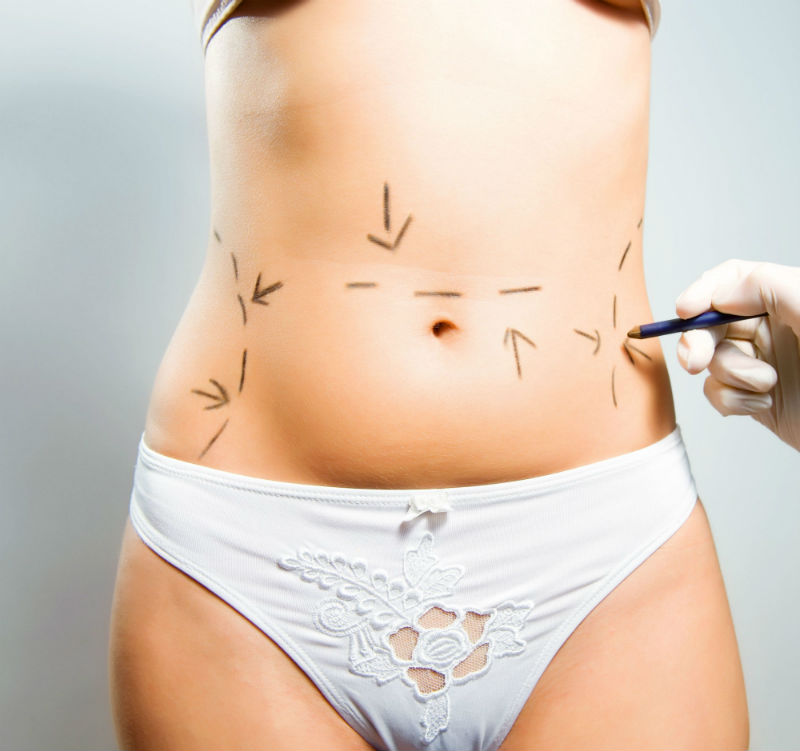 The Three Greatest Benefits of Body Sculpting Surgery