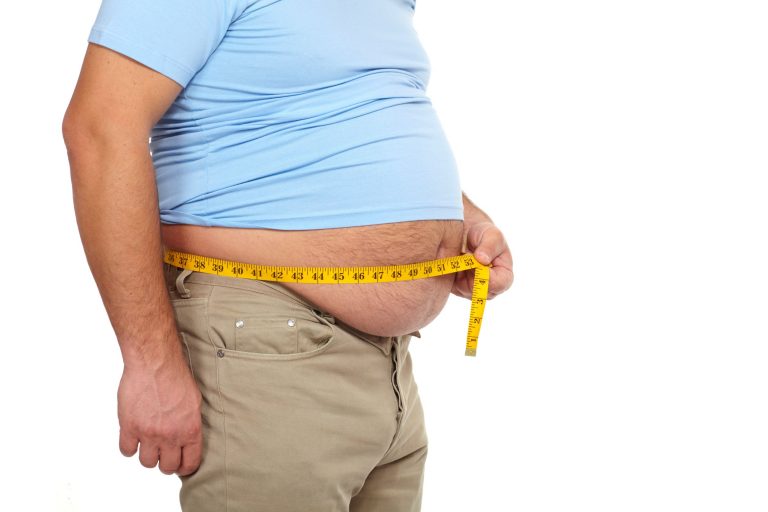 Who Qualifies for Weight Loss Surgery?