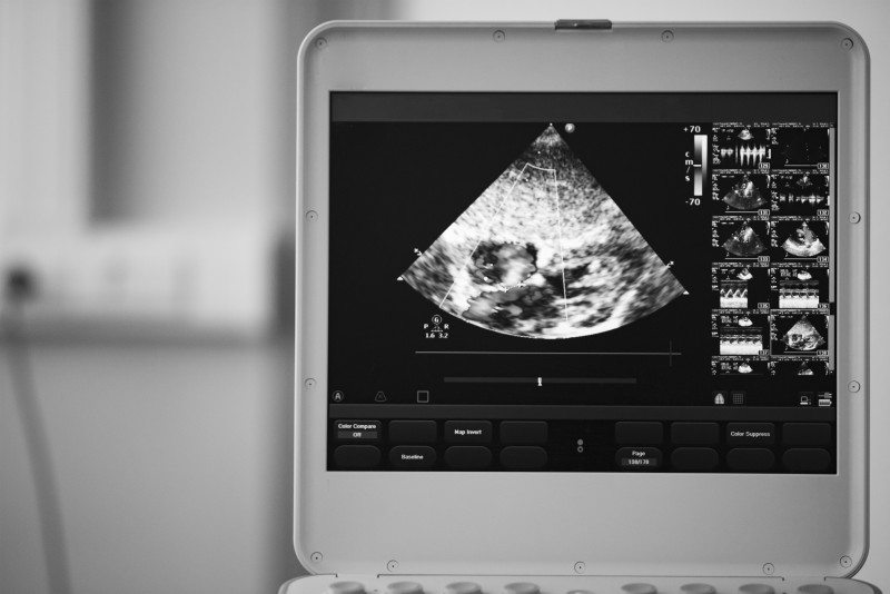 See the Benefits of Using a Portable Machine for Ultrasounds for Patients