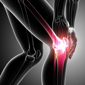 Does Orthotics Knee In Jacksonville FL Really Help?