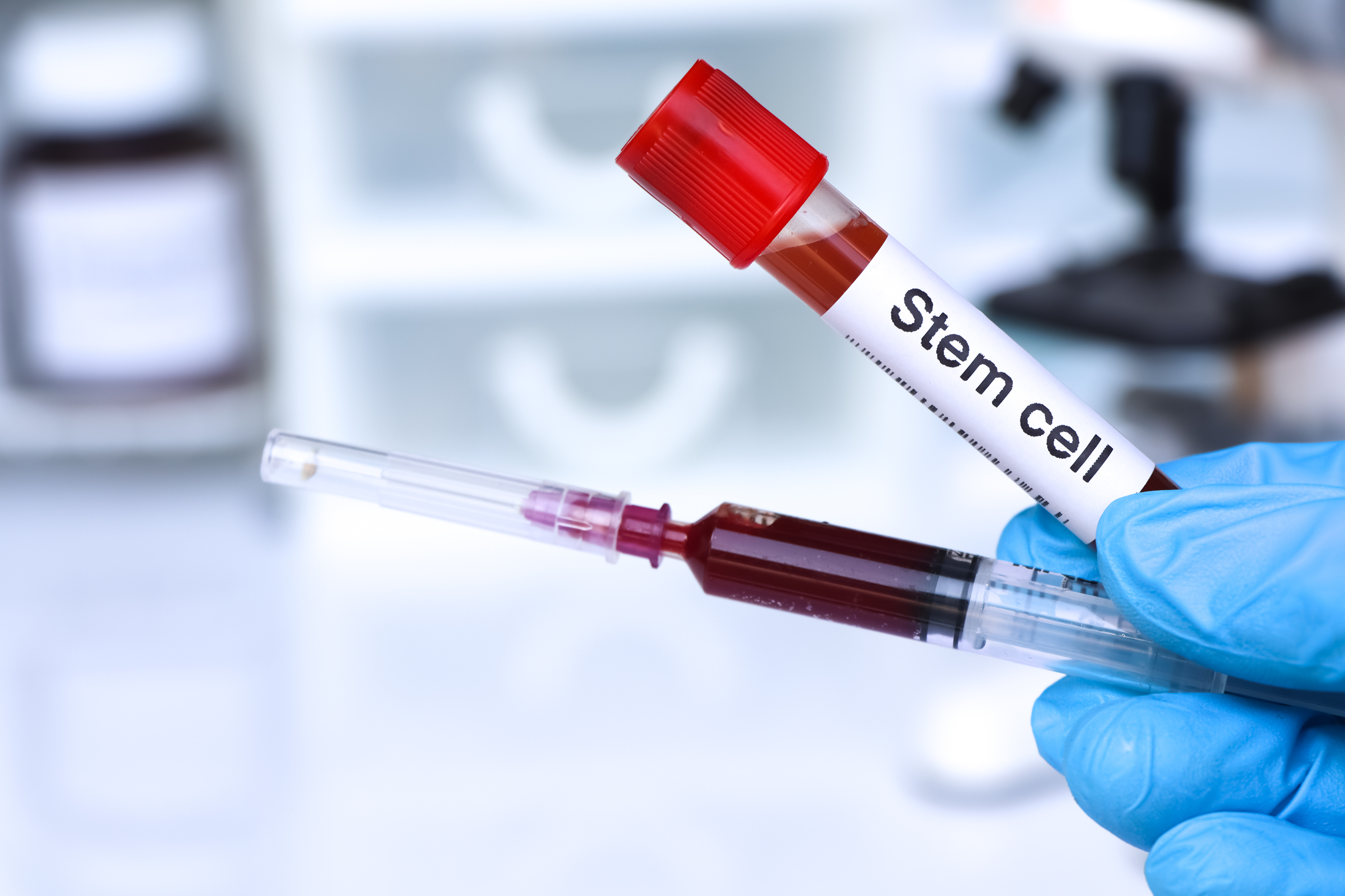 Know More About Stem Cells Medicine in Los Angeles