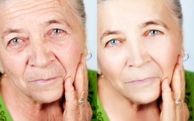 Rhinoplasty in New Jersey: Improving Facial Balance and Respiratory Health