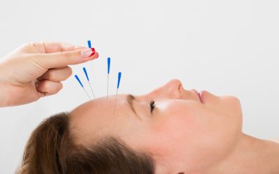 The Healing Power of Acupuncture for Pain in Berkeley, CA