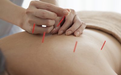 Transform Your Health through Acupuncture Treatment Scottsdale AZ Services
